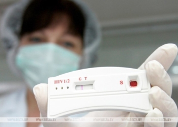 Выявляемость случаев ВИЧ-инфекции в Брестской области в 2022 году возросла почти на 29%