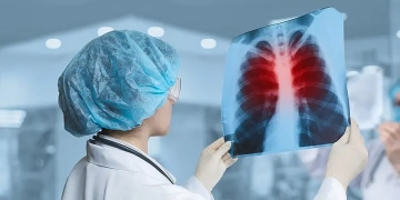 Туберкулез